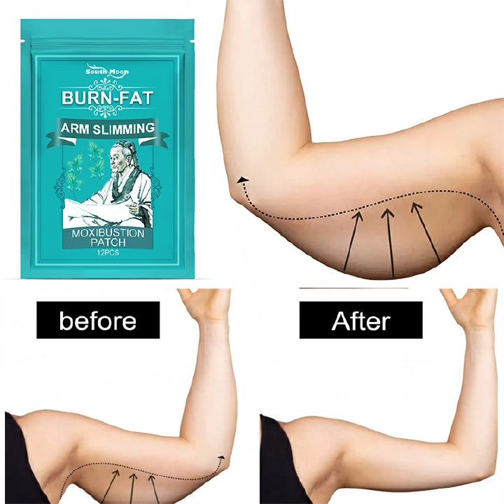 Chinese Herbal Burn-Fat Arm Slimming Patch – 12PCS/BOX