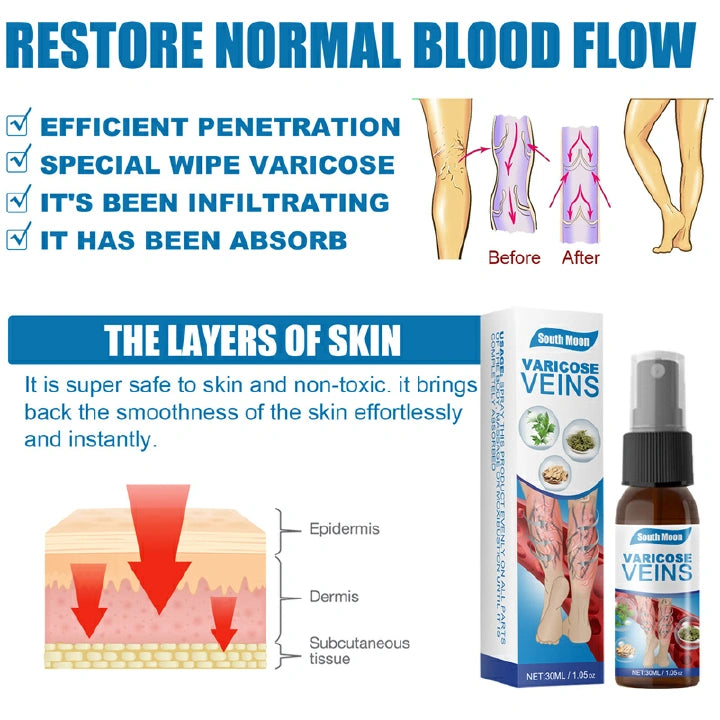 Herbal Relief Varicose Veins Spray