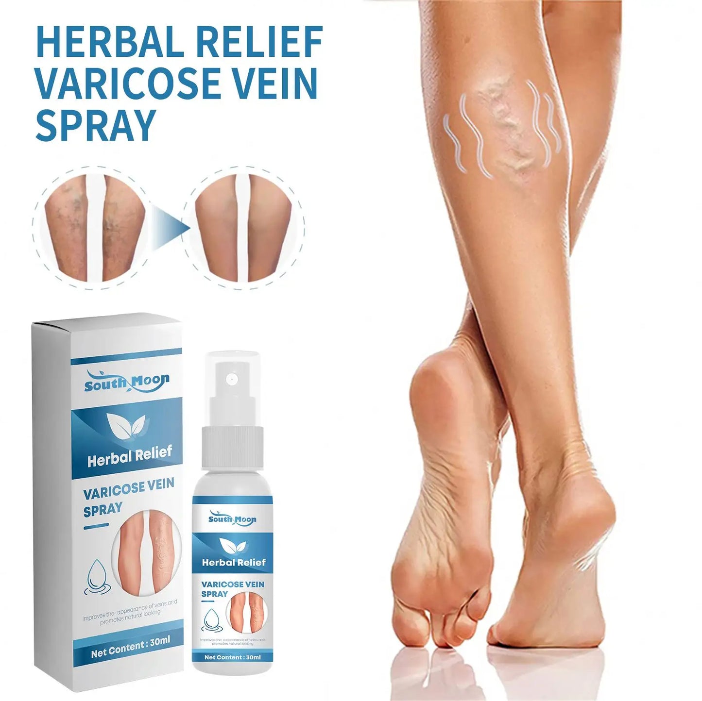 Herbal Relief Varicose Veins Spray