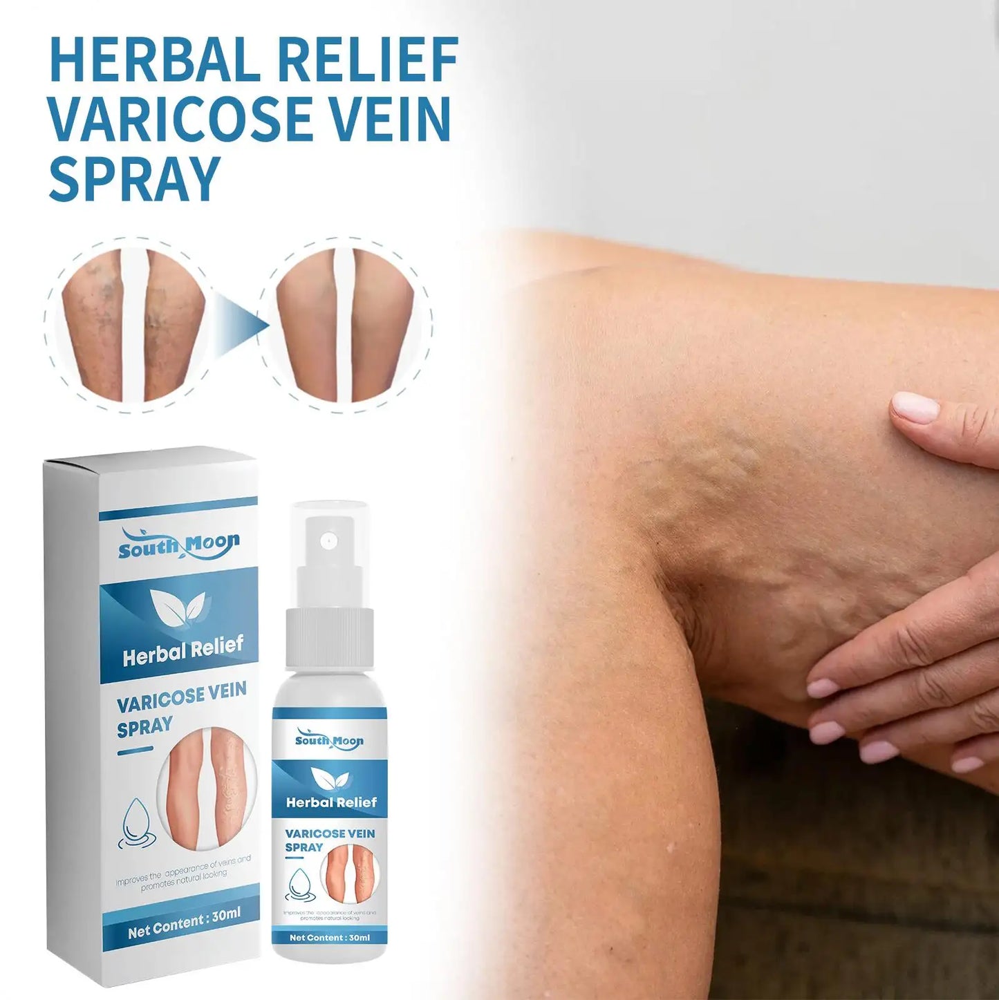 Herbal Relief Varicose Veins Spray