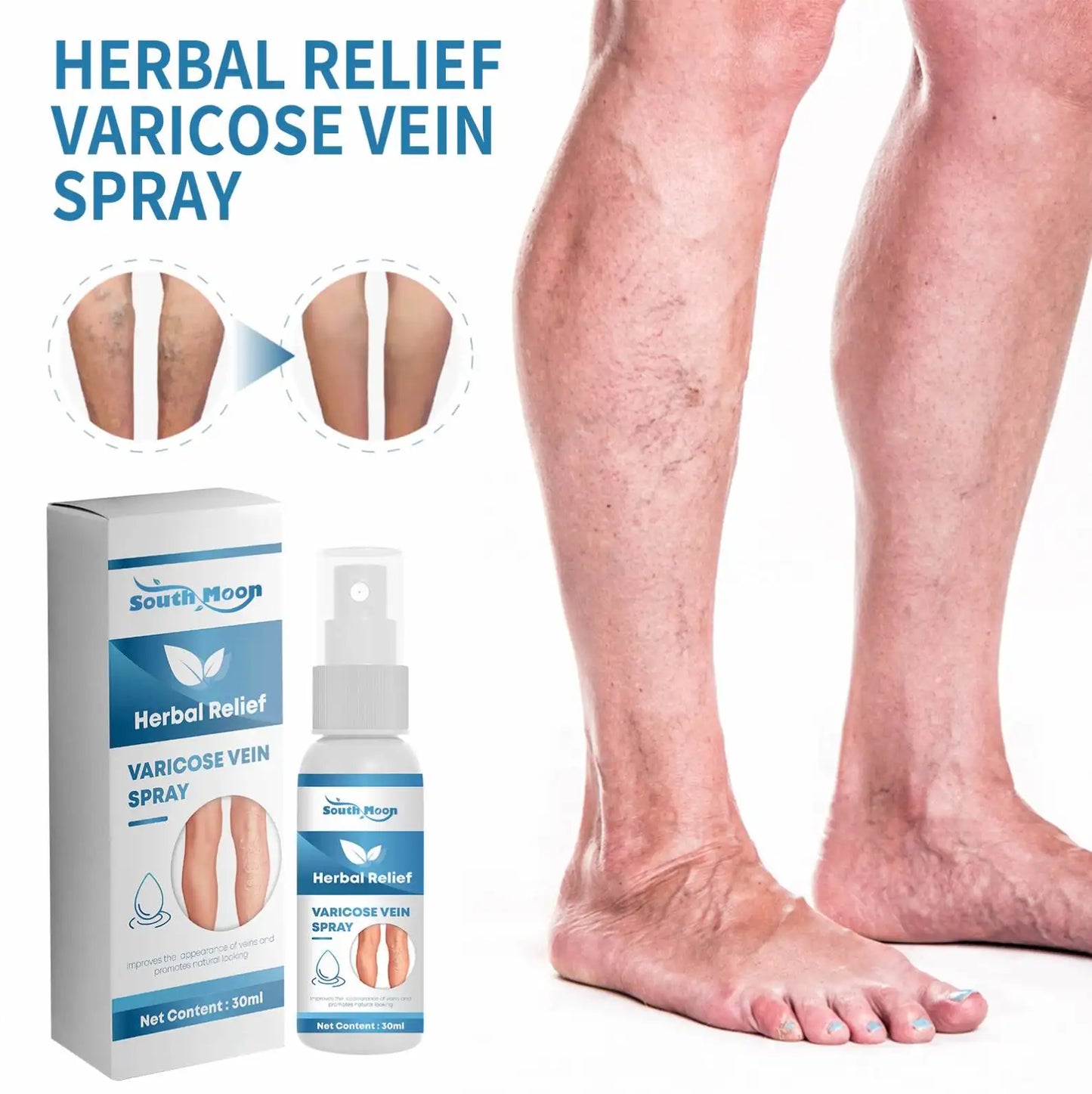 Herbal Relief Varicose Veins Spray