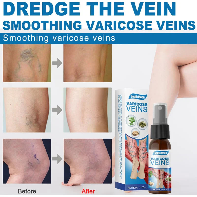 Herbal Relief Varicose Veins Spray