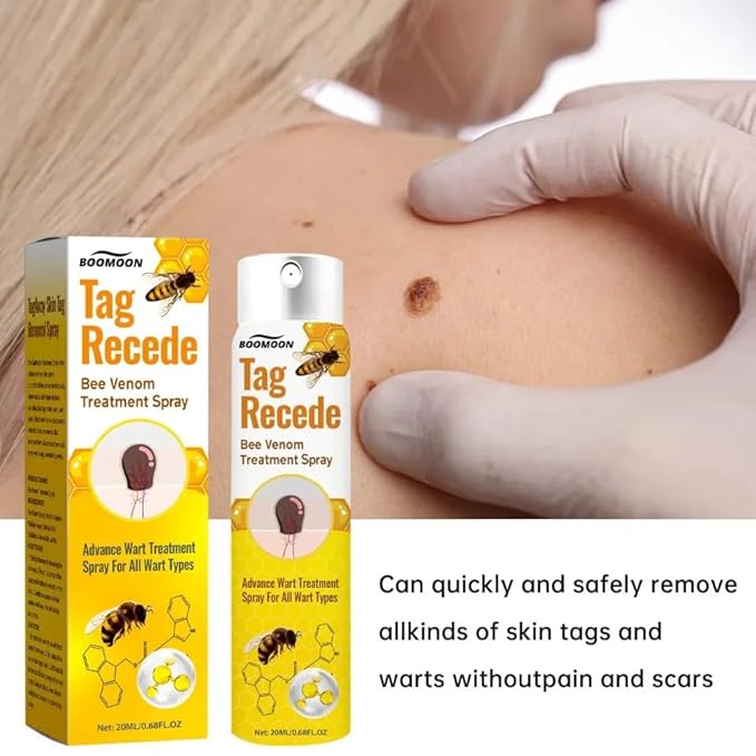 Tag & Wart Remover Spray - Wart and Tags Removal Treatment Spray