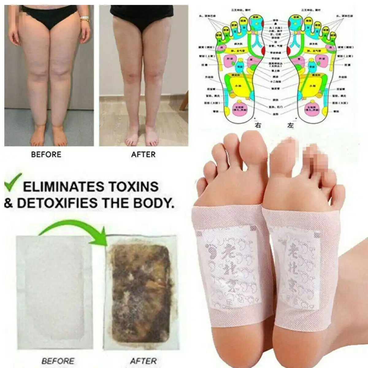 DETOX FOOT PATCHES - 10 PCS