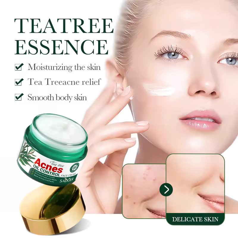 Acne Oil Control Face Cream |Pimple Remover Cream, Get Rid of Pimples Fast for Oily and Acne Prone Skin, Cruelty Free- 50g