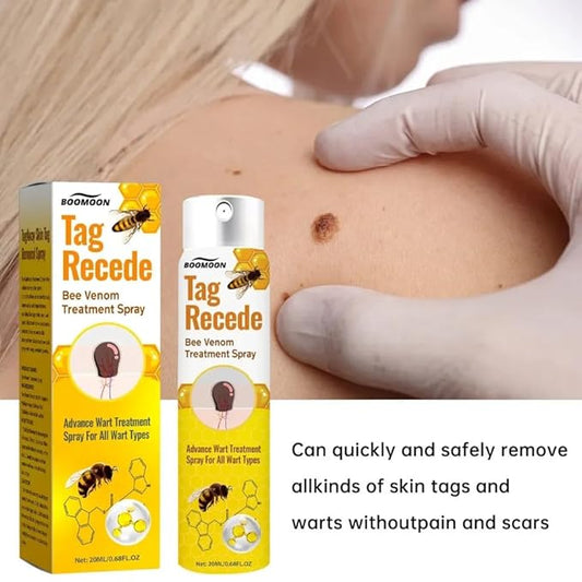 Tag & Wart Remover Spray - Wart and Tags Removal Treatment Spray
